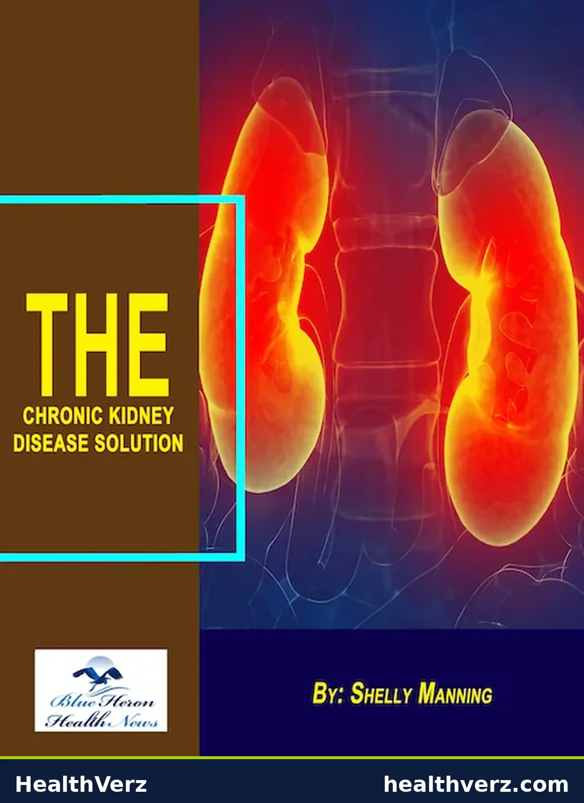 Chronic Kidney Disease Solution details